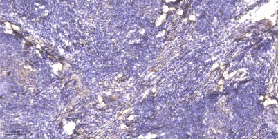 SGK3 (phospho-Thr320) rabbit pAb - image 1