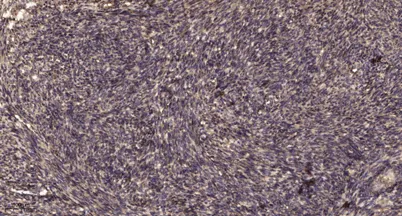 Smad2 (Phospho Ser255) rabbit pAb - image 1