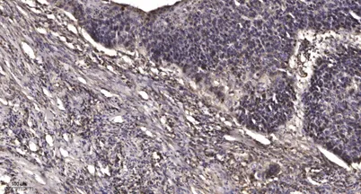 MMP8 (Cleaved-Leu101) rabbit pAb - image 1