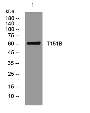 T151B rabbit pAb