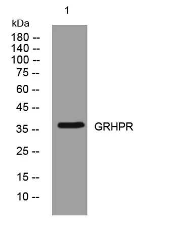 GRHPR rabbit pAb