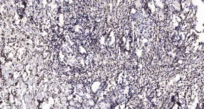 Plasma Kallikrein LC (Cleaved-I391) rabbit pAb - image 1