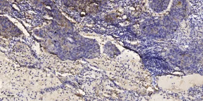 IRS-1 (phospho-Ser302) rabbit pAb - image 1