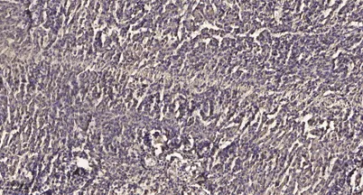 ITGA2B (heavy chain, Cleaved-Leu32) rabbit pAb - image 1