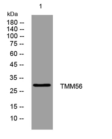 TMM56 rabbit pAb