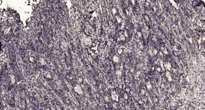 PERM (84k, Cleaved-Ser155) rabbit pAb - image 1