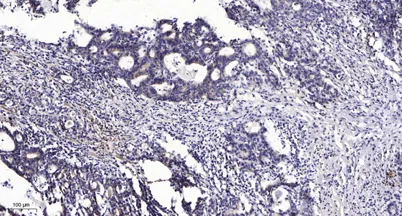Keratin 20 (phospho-Ser13) rabbit pAb