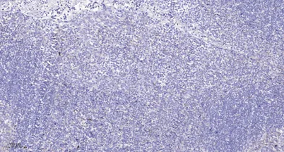 Presenilin 2 rabbit pAb