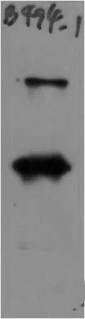 SARS-COV-2 Spike Protein S1 Rabbit pAb - image 1