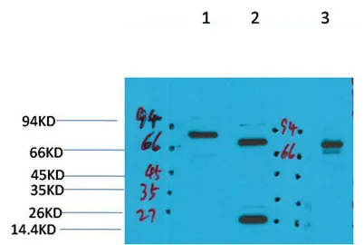 KCNN2 (SK2) rabbit pAb - image 1