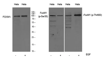 FoxM1 (phospho-Thr600) rabbit pAb