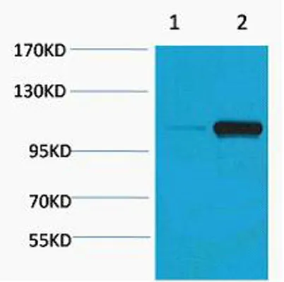 PEPC (Phospho Ser15) rabbit pAb - image 1