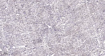 Ku-80 rabbit pAb - image 1