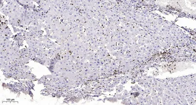 MMP19 (Cleaved-Tyr98) rabbit pAb - image 1
