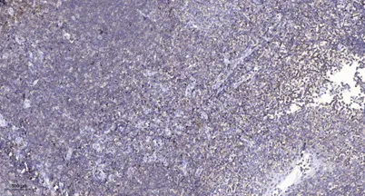 CFTR (Phospho-Ser737) rabbit pAb - image 1