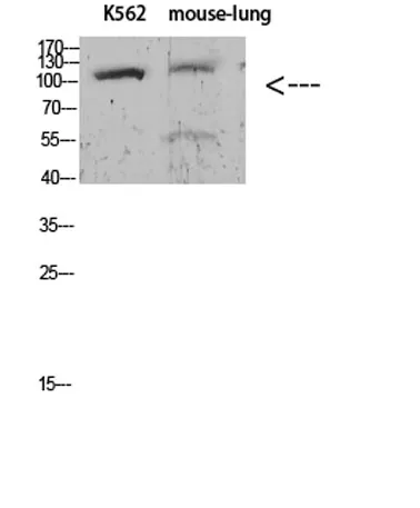 Sodium Potassium ATPase alpha-1 (Phospho-Tyr260) Rabbit pAb - image 1