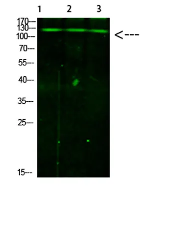 JAK2/3 (Phospho-Tyr966/939) Rabbit pAb