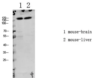 LATS1/2 (Phospho-Thr1079/1041) Rabbit pAb