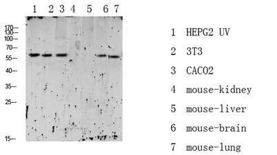 RIPK2 (Phospho-Ser176) Rabbit pAb - image 1