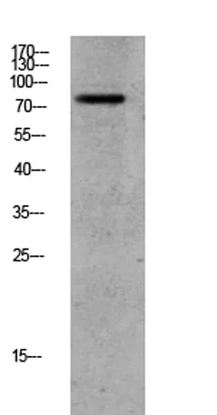 GRK2 (Phospho-Ser685) Rabbit pAb - image 1