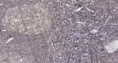 DAPK1 (Phospho-Ser308) rabbit pAb