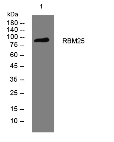 RBM25 rabbit pAb