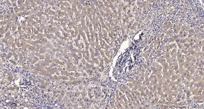 Tie2 (phospho-Ser1119) rabbit pAb
