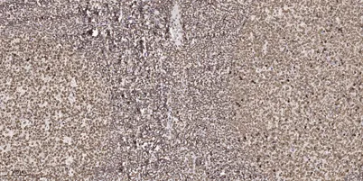 PKM2 rabbit pAb - image 1