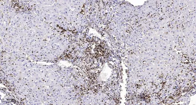 MMP7 (Cleaved-Tyr95) rabbit pAb - image 1
