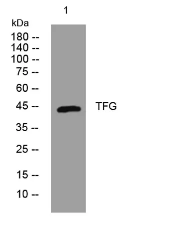 TFG rabbit pAb