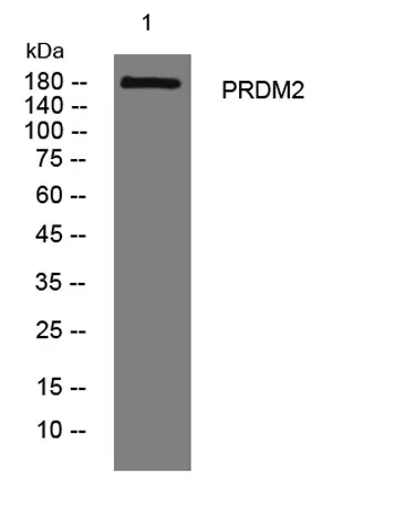 PRDM2 rabbit pAb - image 1