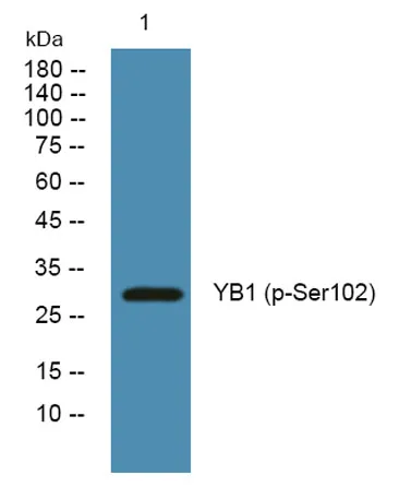 YB1 (phospho-Ser102) rabbit pAb - image 1