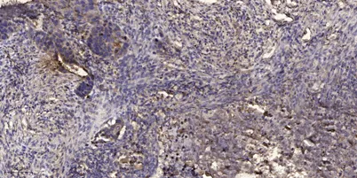 IP3 Receptor (Phospho Tyr353) rabbit pAb - image 1