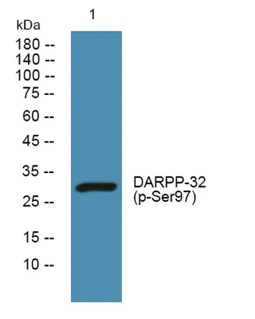 DARPP-32 (phospho-Ser97) rabbit pAb - image 1