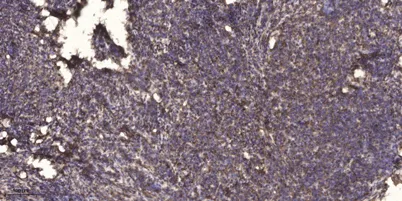 MT-ATP8 Rabbit pAb - image 1