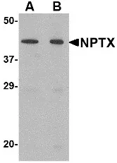 NPTX2 Rabbit Polyclonal Antibody - image 1