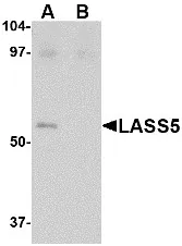 Lass5 (CERS5) (C-term) Rabbit Polyclonal Antibody - image 1