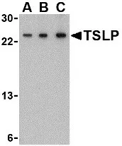 TSLP Rabbit Polyclonal Antibody - image 1