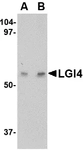 LGI4 Rabbit Polyclonal Antibody - image 1