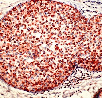 Cathepsin D (CTSD) Rabbit Polyclonal Antibody - image 1