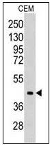 Aldolase C (ALDOC) (C-term) Rabbit Polyclonal Antibody - image 1
