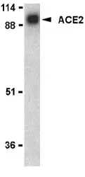 Angiotensin Converting Enzyme 2 (ACE2) (N-term) Rabbit Polyclonal Antibody - image 1