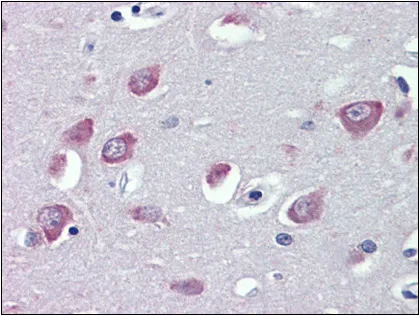 TRPC1 (722-733) Goat Polyclonal Antibody - image 1