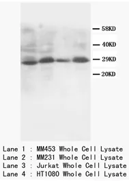SSX2 (C-term) Rabbit Polyclonal Antibody - image 1