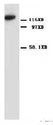 Nogo A (RTN4) (Isoform 1) (C-term) Rabbit Polyclonal Antibody - image 1