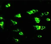 NMDAR2B (GRIN2B) (N-term) Rabbit Polyclonal Antibody - image 1