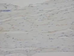 C Reactive Protein (CRP) (N-term) Rabbit Polyclonal Antibody - image 1