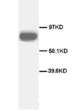CD71 (TFRC) (C-term) Rabbit Polyclonal Antibody - image 1