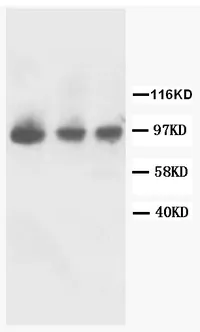 FGFR2 (C-term) Rabbit Polyclonal Antibody - image 1