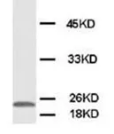 PMVK Rabbit Polyclonal Antibody - image 1